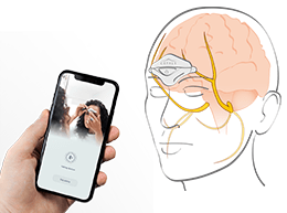 MyFutureProduct case - Cefaly